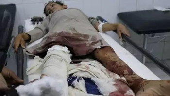 إصابة 4 أطفال أشقاء في قصف حوثي استهدف منزلهم في الضالع