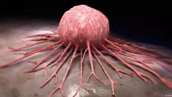 اكتشاف طبي جديد.. انعدام الجاذبية يقتل الخلايا السرطانية