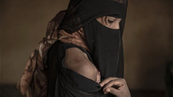 زهرة وأخواتها.. رحلات هجرة من إثيوبيا تتحول لأيام تعذيب على يد المهربين في اليمن