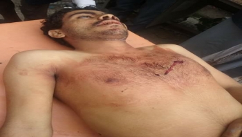 إب في زمن الانقلاب.. حوادث قتل يومية تسجَّل ضد مجهولين