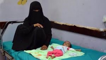 الأمم المتحدة: وفاة أم يمنية كل ساعتين بسبب الولادة