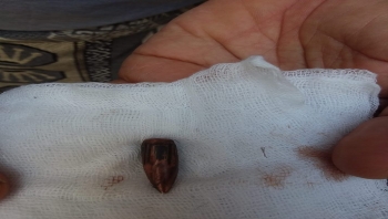 مقتل شاب برصاص راجع في إب وسط فوضى أمنية