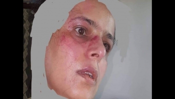 مليشيا الحوثي تعتدي على الناشطة "ابتسام أبو دنيا" في صنعاء