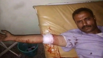 مليشيات مدعومة إماراتيا تطلق النار على مسيرة في ريف تعز وإصابة متظاهرين بجروح