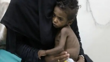 مسؤول أممي: 10 ملايين يمني على بعد خطوة من المجاعة