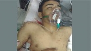 إب .. مقتل لاعب كرة قدم برصاص مسلحين جماعة الحوثي