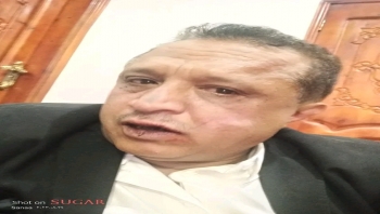 صنعاء ...عصابة تعتدي بالضرب على الصحفي مجلي الصمدي