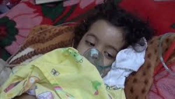 الصحة العالمية: مليونا طفل يمني دون سن الخامسة يعانون من الهُزال