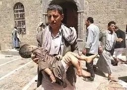 الأمم المتحدة: 230 ألف مدني قتلوا منذ بداية الصراع في اليمن
