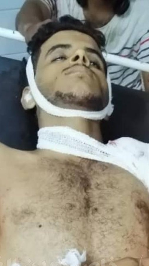 مقتل شاب في المعلا بعدن برصاص مليشيا الحزام الأمني