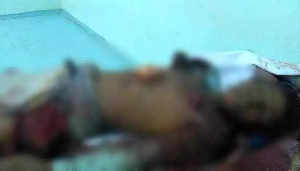 مقتل طفل في انفجار لغم بمديرية الخوخة جنوبي الحديدة