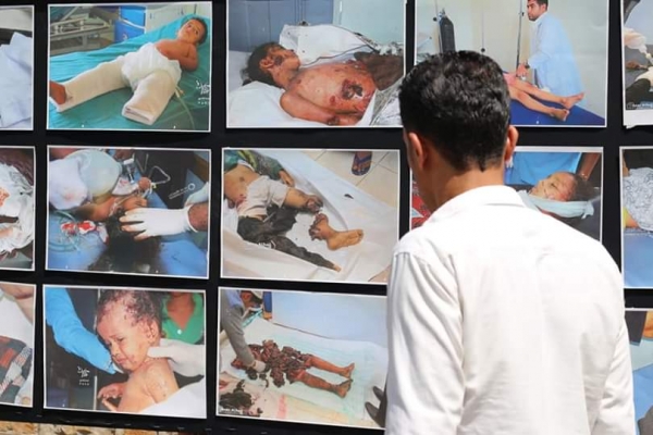 تعز..معرض صور لتجسيد انتهاكات مليشيا الحوثي