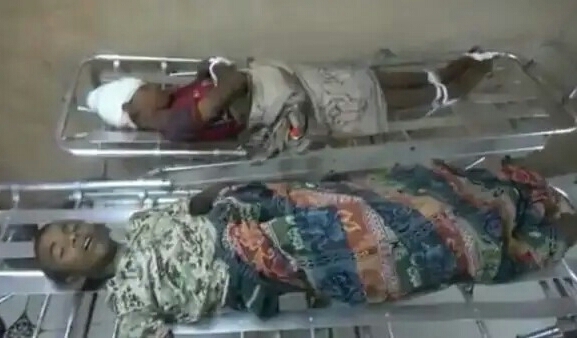 مقتل طفلين بانفجار لغم أرضي زرعه الحوثيون قرب منزلهما في الدريهمي بالحديدة