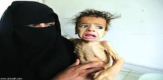 مليشيات الحوثي ترغم السكان للتبرع للجبهات وتتجاهل ملايين الجوعى