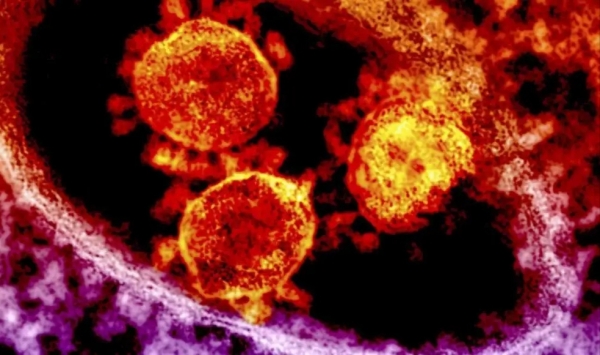 لماذا تسجل قارة أفريقيا القليل من إصابات فيروس كورونا؟