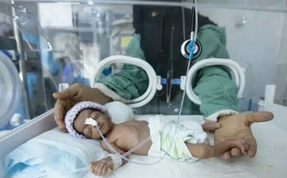 الأمم المتحدة تعلق خدمات الصحة الإنجابية في 140 مرفقا طبيا باليمن