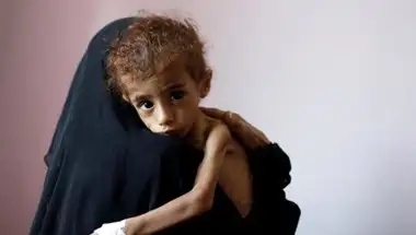 الأمم المتحدة تحذّر: خطر مجاعة جديد في اليمن