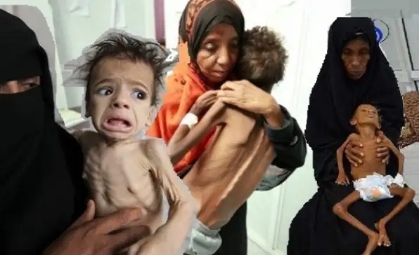 الصليب الأحمر: 66% من اليمنيين لا يملكون الطعام