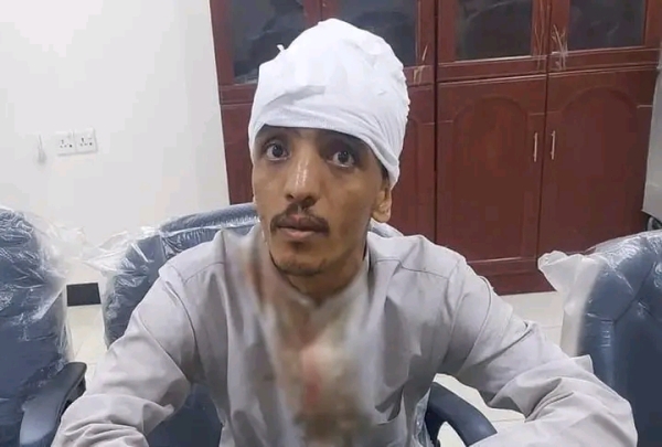 تعرض ناشط ومصور للاعتداء في عدن بدعوى العمل لصالح قناة المهرية
