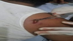 إصابة مواطنين برصاص المليشيات الحوثية شرق إب