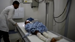 إصابة طفل إثر قصف شنه الحوثيون على "الغيل" بالجوف