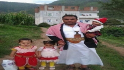 إب..وفاة مختطف بعد أسابيع من الإفراج عنه من سجون مليشيا الحوثي متأثرا بعمليات تعذيب