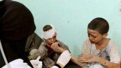 قتلى مدنيون بقصف سعودي إماراتي على حجة وصعدة