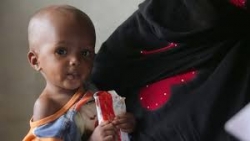 اليونيسف تحذّر: ستة ملايين طفل باليمن على بُعد خطوة من المجاعة
